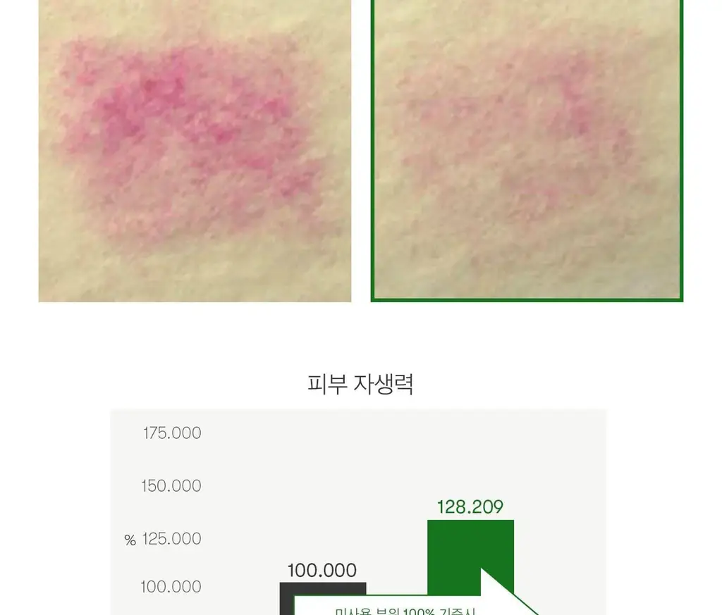 [모공케어] VT 리들샷 700 에센스 30ml 상세페이지 13